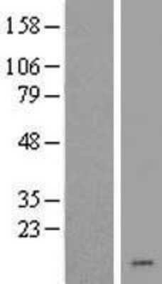 Western Blot: CHCHD7 Overexpression Lysate (Adult Normal) [NBL1-09145] Left-Empty vector transfected control cell lysate (HEK293 cell lysate); Right -Over-expression Lysate for CHCHD7.