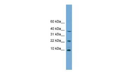 Western Blot: CHCHD8 Antibody [NBP2-82672] - WB Suggested Anti-CHCHD8 Antibody Titration: 0.2-1 ug/ml. Positive Control: Jurkat cell lysate