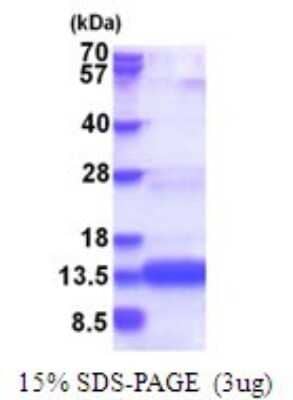 SDS-Page: CHCHD8 Recombinant Protein [NBP2-51728] - 15% SDS Page (3 ug)