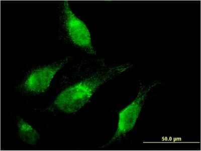 Immunocytochemistry/Immunofluorescence: CHD1 Antibody (1G2) [H00001105-M04] - Analysis of monoclonal antibody to CHD1 on HeLa cell. Antibody concentration 10 ug/ml