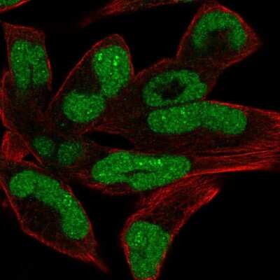 Immunocytochemistry/Immunofluorescence: CHD1 Antibody [NBP2-14478] - Staining of human cell line RH-30 shows localization to nucleus & nucleoli fibrillar center. Antibody staining is shown in green.