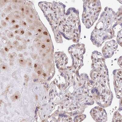 Immunohistochemistry-Paraffin: CHD1 Antibody [NBP2-14478] - Staining of human placenta shows moderate to strong nuclear positivity.