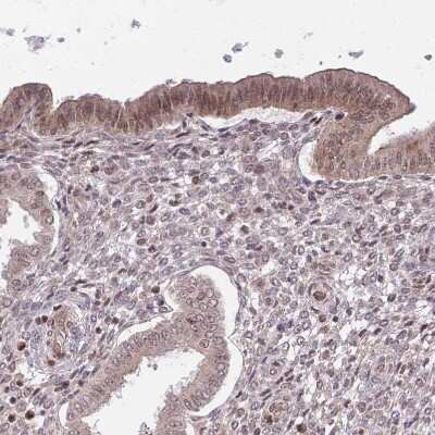 Immunohistochemistry-Paraffin: CHD1 Antibody [NBP2-14478] - Staining of human endometrium shows weak to moderate cytoplasmic positivity in glandular cells.