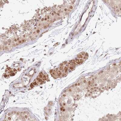 Immunohistochemistry-Paraffin: CHD1 Antibody [NBP2-14478] - Staining of human testis shows moderate nuclear positivity in cells in seminiferous ducts.