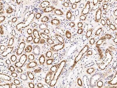 Immunohistochemistry-Paraffin: CHD1 Antibody [NBP2-98902] - Human kidney with rabbit polyclonal antibody (1:300).