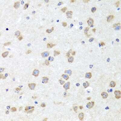 Immunohistochemistry-Paraffin: CHD1 Antibody [NBP3-02966] - Mouse brain using CHD1 antibody (NBP3-02966) at dilution of 1:100 (40x lens).