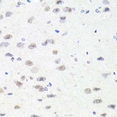 Immunohistochemistry-Paraffin: CHD1 Antibody [NBP3-02966] - Rat brain using CHD1 antibody (NBP3-02966) at dilution of 1:100 (40x lens).