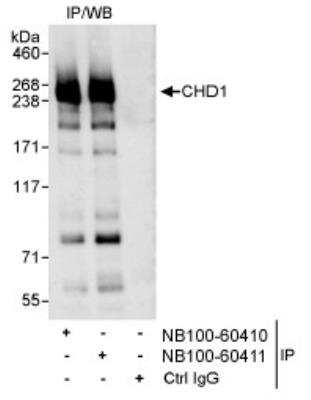 Immunoprecipitation: CHD1 Antibody [NB100-60410] - Detection of Human CHD1 on HeLa whole cell lysate using NB100-60410. CHD1 was also immunoprecipitated by rabbit anti-CHD1 antibody NB100-60411.