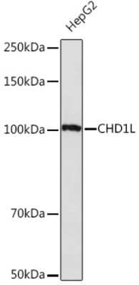 Western Blot: CHD1L Antibody (3C1O9) [NBP3-15541] - Western blot analysis of extracts of HepG2 cells, using CHD1L Rabbit mAb (NBP3-15541) at 1:1000 dilution. Secondary antibody: HRP Goat Anti-Rabbit IgG (H+L) at 1:10000 dilution. Lysates/proteins: 25ug per lane. Blocking buffer: 3% nonfat dry milk in TBST. Detection: ECL Basic Kit. Exposure time: 30s.