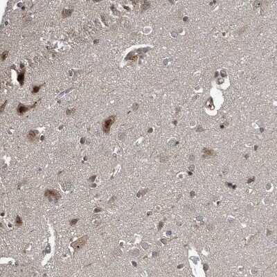 Immunohistochemistry-Paraffin: CHD1L Antibody [NBP1-89154] - Staining of human cerebral cortex shows strong nuclear positivity in neurons.