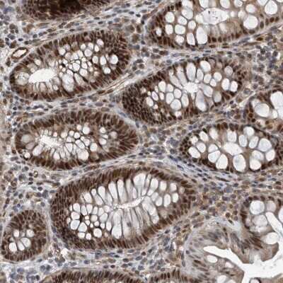 Immunohistochemistry-Paraffin: CHD1L Antibody [NBP1-89154] - Staining of human colon shows strong nuclear positivity in glandular cells.