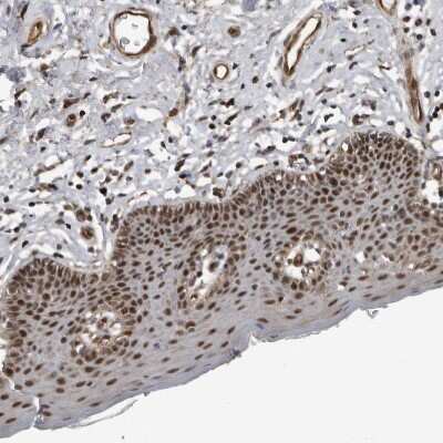 Immunohistochemistry-Paraffin: CHD1L Antibody [NBP1-89154] - Staining of human skin shows strong nuclear positivity in squamous epithelial cells.
