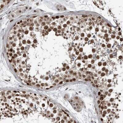 Immunohistochemistry-Paraffin: CHD1L Antibody [NBP1-89154] - Staining of human testis shows strong nuclear positivity in cells in seminiferous ducts.