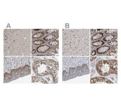 Immunohistochemistry-Paraffin: CHD1L Antibody [NBP1-89154] - Staining of human cerebral cortex, lower gastrointestinal, skin and testis using Anti-CHD1L antibody NBP1-89154 (A) shows similar protein distribution across tissues to independent antibody.