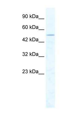 Western Blot: CHD1L Antibody [NBP1-57105] - Jurkat cell lysate, concentration 2.5 ug/ml.