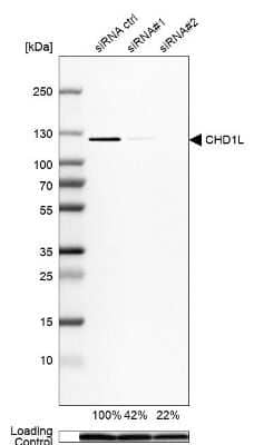 Western Blot: CHD1L Antibody [NBP1-89154] - Analysis in Hep-G2 cells transfected with control siRNA, target specific siRNA probe #1 and #2, using Anti-CHD1L antibody. Remaining relative intensity is presented. Loading control: Anti-GAPDH.