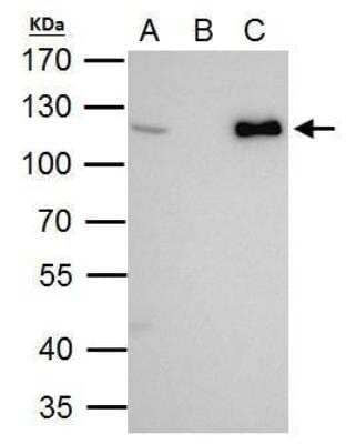 Western Blot: CHD1L Antibody [NBP2-59305] - CHD1L antibody immunoprecipitates CHD1L protein in IP experiments. IP Sample: 293T whole cell lysate/extract A. 40 ug 293T whole cell lysate/extract B. Control with 2 ug of preimmune rabbit IgG C. Immunoprecipitation of CHD1L protein by 2 ug of CHD1L antibody 7.5% SDS-PAGE The immunoprecipitated CHD1L protein was detected by CHD1L antibody  diluted at 1:1000.