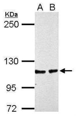Western Blot: CHD1L Antibody [NBP2-59305] - Sample (30 ug of whole cell lysate)  A: HepG2  B: HepG2 nucleus 5% SDS PAGE. Used at a dilution of 1:3000
