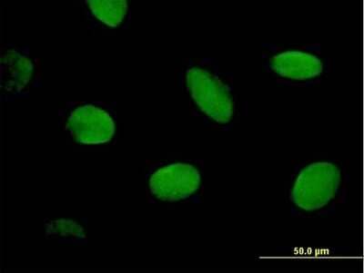 Immunocytochemistry/Immunofluorescence: CHD2 Antibody [H00001106-B01P] - Analysis of purified antibody to CHD2 on HeLa cell. (antibody concentration 10 ug/ml)