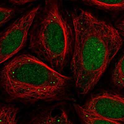 Immunocytochemistry/ Immunofluorescence CHD2 Antibody