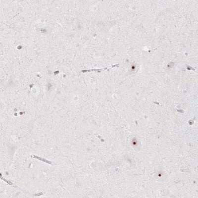 Immunohistochemistry-Paraffin CHD2 Antibody - BSA Free