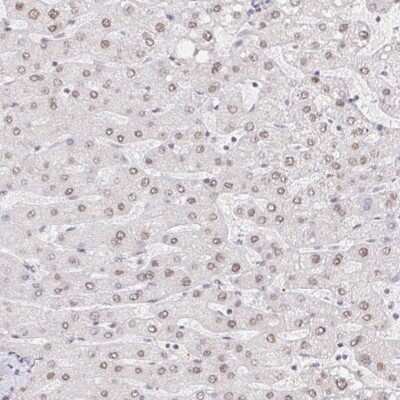 Immunohistochemistry-Paraffin CHD2 Antibody