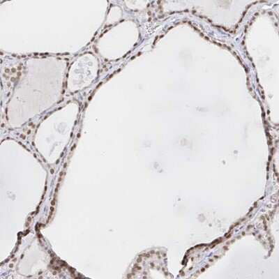 Immunohistochemistry-Paraffin CHD2 Antibody