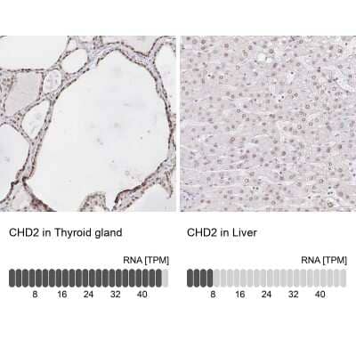 Immunohistochemistry-Paraffin: CHD2 Antibody [NBP2-32563] - Staining in human thyroid gland and liver tissues using anti-CHD2 antibody. Corresponding CHD2 RNA-seq data are presented for the same tissues.