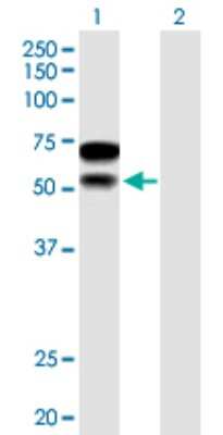 Western Blot: CHD2 Antibody [H00001106-B01P] - Analysis of CHD2 expression in transfected 293T cell line by CHD2 polyclonal antibody.  Lane 1: CHD2 transfected lysate(55.11 KDa). Lane 2: Non-transfected lysate.
