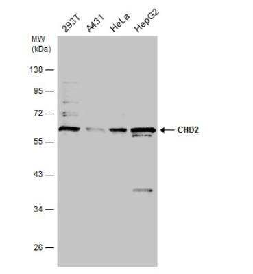 Western Blot: CHD2 Antibody [NBP1-33428] - Various whole cell extracts (30 ug) were separated by 10% SDS-PAGE, and the membrane was blotted with CHD2 antibody [N1N2], N-term  diluted at 1:1000.