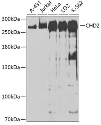 Western Blot: CHD2 Antibody [NBP2-92117] - Analysis of extracts of various cell lines, using CHD2 at 1:1000 dilution.Secondary antibody: HRP Goat Anti-Rabbit IgG (H+L) at 1:10000 dilution.Lysates/proteins: 25ug per lane.Blocking buffer: 3% nonfat dry milk in TBST.Detection: ECL Basic Kit .Exposure time: 90s.