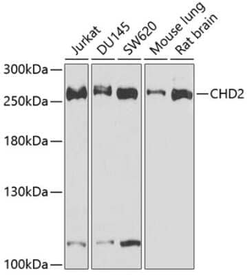 Western Blot: CHD2 Antibody [NBP2-92463] - Analysis of extracts of various cell lines, using CHD2 at 1:1000 dilution.Secondary antibody: HRP Goat Anti-Rabbit IgG (H+L) at 1:10000 dilution.Lysates/proteins: 25ug per lane.Blocking buffer: 3% nonfat dry milk in TBST.Detection: ECL Basic Kit .Exposure time: 30s.