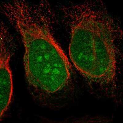 Immunocytochemistry/Immunofluorescence: CHD3 Antibody [NBP2-57564] - Staining of human cell line U-2 OS shows localization to nucleus & nucleoli.