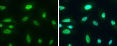 Immunocytochemistry/Immunofluorescence: CHD3 Antibody [NBP3-13040] - CHD3 antibody detects CHD3 protein at cytoplasm and nucleus by immunofluorescent analysis. Sample: HeLa cells were fixed in 4% paraformaldehyde at RT for 15 min. Green: CHD3 protein stained by CHD3 antibody (NBP3-13040) diluted at 1:500. Blue: Hoechst 33342 staining.