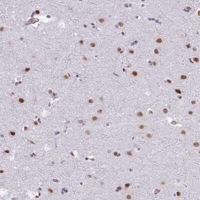 Immunohistochemistry-Paraffin: CHD3 Antibody [NBP2-14479] - Staining of human cerebral cortex shows distinct nuclear positivity in neuronal cells.