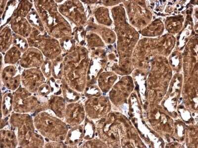 Immunohistochemistry-Paraffin: CHD3 Antibody [NBP3-13040] - CHD3 antibody detects CHD3 protein at cytoplasm and nucleus in mouse kidney by immunohistochemical analysis. Sample: Paraffin-embedded mouse kidney. CHD3 antibody (NBP3-13040) diluted at 1:500. Antigen Retrieval: Citrate buffer, pH 6.0, 15 min