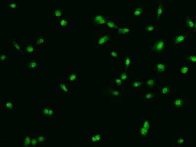 Immunocytochemistry/Immunofluorescence: CHD5 Antibody [NBP3-06267] - Immunofluorescence staining of CHD5 in PC3 cells. Cells were fixed with 4% PFA, permeabilzed with 0.1% Triton X-100 in PBS,blocked with 10% serum, and incubated with rabbit anti-Human CHD5 polyclonal antibody (dilution ratio 1:200) at 4 degrees celsius overnight. Then cells were stained with the Alexa Fluor (TM) 488-conjugated Goat Anti-rabbit IgG secondary antibody (green). Positive staining was localized to Nucleus and Cytoplasm.