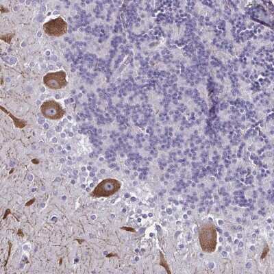 Immunohistochemistry: CHD5 Antibody [NBP2-49186] - Staining of human cerebellum shows strong cytoplasmic positivity in Purkinje cells.