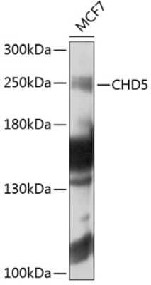 Western Blot: CHD5 Antibody [NBP2-92563] - Analysis of extracts of MCF-7 cells, using CHD5 .Exposure time: 10s.