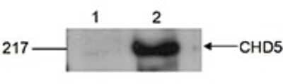 Western Blot: CHD5 Antibody [NBP3-18636] - Figure 2. Western blot analysis using the antibody directed against CHD5 HeLa cells were transfected with CHD5 and analysed by Western blot. Western blot was performed using 15 to 30 ug nuclear extracts and the antibody against human CHD5 . The antibody was diluted 1:1,000 in TBS-Tween containing 2% milk powder. The position of the protein of interest (expected size: 223 kDa) is indicated on the right; the marker (in kDa) is shown on the left. Lane 1 shows the result of the untransfected cells, lane 2 of the transfected cells. Western blot performed by Sonia Mulero, Spanish National Cancer Research Centre (CNIO), Madrid, Spain.