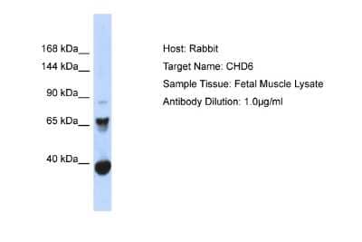 Western Blot: CHD6 Antibody [NBP2-83972] - Host: Rabbit. Target Name: CHD6. Sample Type: Fetal Muscle lysates. Antibody Dilution: 1.0ug/ml