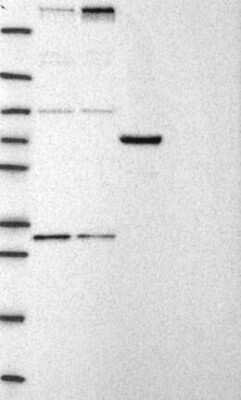 Western Blot: CHD8 Antibody [NBP3-17355] - Lane 1: Marker [kDa] 250, 130, 95, 72, 55, 36, 28, 17, 10;   Lane 2: RT4;   Lane 3: U-251 MG;   Lane 4: Human Plasma;   Lane 5: Liver;   Lane 6: Tonsil