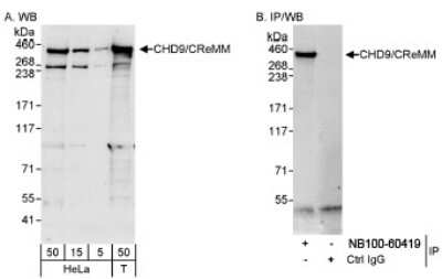 Western Blot: CHD9 Antibody [NB100-60419] - Detection of Human CHD9/CReMM on HeLa whole cell lysate using NB100-60419.