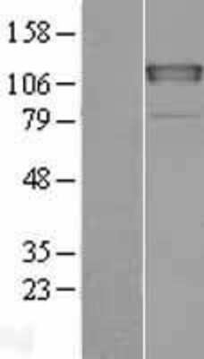 Western Blot: CHERP Overexpression Lysate (Adult Normal) [NBL1-09148] Left-Empty vector transfected control cell lysate (HEK293 cell lysate); Right -Over-expression Lysate for CHERP.