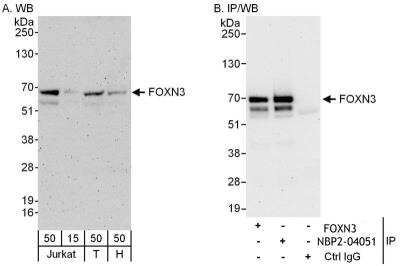 Immunoprecipitation CHES1 Antibody