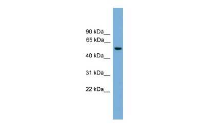 Western Blot: CHES1 Antibody [NBP2-84674] - WB Suggested Anti-FOXN3 Antibody Titration: 0.2-1 ug/ml. ELISA Titer: 1:1562500. Positive Control: Human Liver