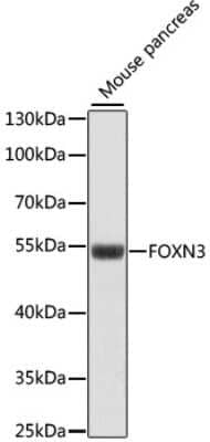 Western Blot: CHES1 Antibody [NBP2-92204] - Analysis of extracts of mouse pancreas, using CHES1 at 1:1000 dilution.Secondary antibody: HRP Goat Anti-Rabbit IgG (H+L) at 1:10000 dilution.Lysates/proteins: 25ug per lane.Blocking buffer: 3% nonfat dry milk in TBST.Detection: ECL Basic Kit .Exposure time: 90s.