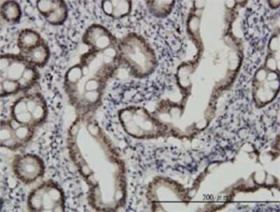 Immunohistochemistry-Paraffin: CHFR Antibody (1H3-A12) [H00055743-M01] - Analysis of monoclonal antibody to CHFR on formalin-fixed paraffin-embedded human small Intestine. Antibody concentration 2 ug/ml.