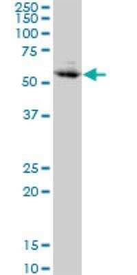 Western Blot: CHFR Antibody (1H3-A12) [H00055743-M01] - Western Blot analysis of CHFR expression in A-431 ( Cat # L015V1 ).