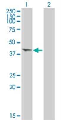 Western Blot: CHI3L1 Antibody [H00001116-B01P] - analysis of CHI3L1 expression in transfected 293T cell line by CHI3L1 purified MaxPab polyclonal antibody (B01P). Lane 1: CHI3L1 transfected lysate (42.60 KDa). Lane 2: Non-transfected lysate.